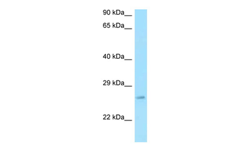 RPS3 Rabbit Polyclonal Antibody