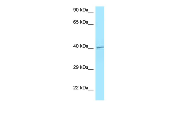 IL3RA Rabbit Polyclonal Antibody
