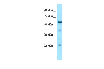 TUBB3 Rabbit Polyclonal Antibody