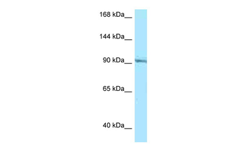RASGRP1 Rabbit Polyclonal Antibody