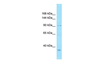 MCPH1 Rabbit Polyclonal Antibody
