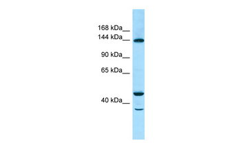 TBC1D4 Rabbit Polyclonal Antibody