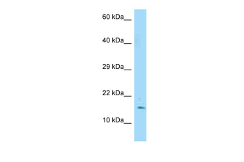 MYDGF Rabbit Polyclonal Antibody