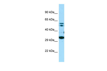 COQ7 Rabbit Polyclonal Antibody