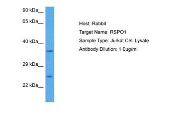 RSPO1 Rabbit Polyclonal Antibody