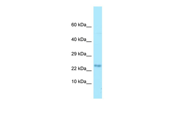 MOBP Rabbit Polyclonal Antibody
