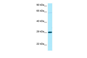 NIPA1 Rabbit Polyclonal Antibody