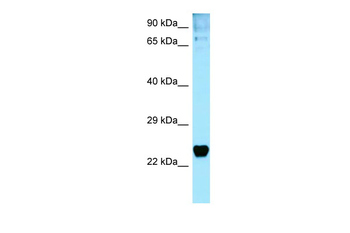 TP53I3 Rabbit Polyclonal Antibody
