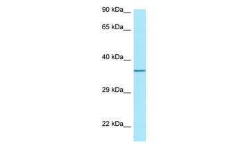 TP53I3 Rabbit Polyclonal Antibody