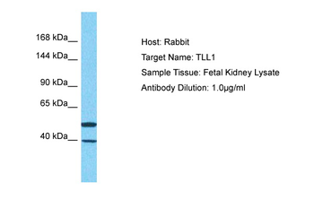 TLL1 Rabbit Polyclonal Antibody