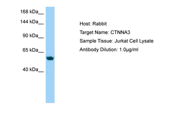 CTNNA3 Rabbit Polyclonal Antibody