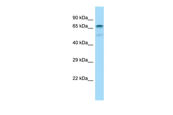 CABLES1 Rabbit Polyclonal Antibody
