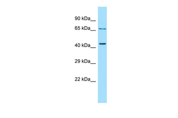 PTH2R Rabbit Polyclonal Antibody