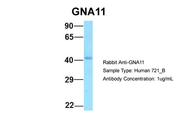 GNA11 Rabbit Polyclonal Antibody