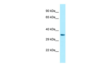 P2RY14 Rabbit Polyclonal Antibody