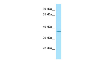 LGI4 Rabbit Polyclonal Antibody