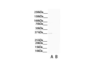 C1QTNF3 Rabbit Polyclonal Antibody