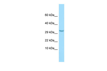 C1QTNF3 Rabbit Polyclonal Antibody