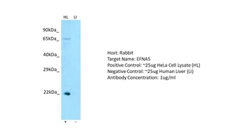 EFNA5 Rabbit Polyclonal Antibody