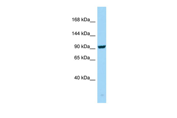 SEZ6 Rabbit Polyclonal Antibody