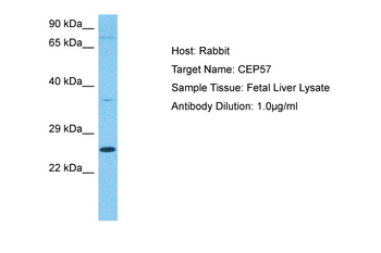CEP57 Rabbit Polyclonal Antibody