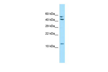 MRPL41 Rabbit Polyclonal Antibody