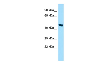 DACT3 Rabbit Polyclonal Antibody