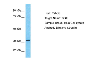 SGTB Rabbit Polyclonal Antibody