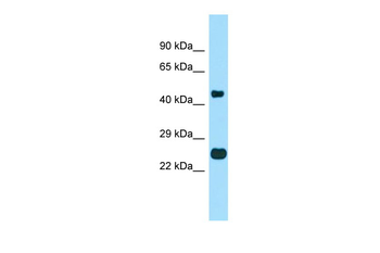 TMBIM4 Rabbit Polyclonal Antibody