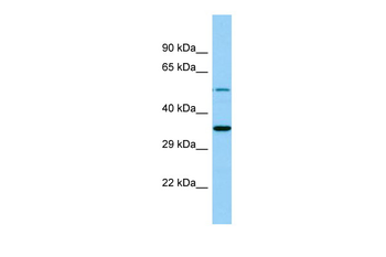 MBOAT4 Rabbit Polyclonal Antibody