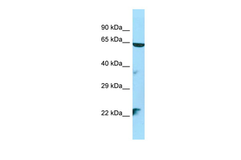 STK35 Rabbit Polyclonal Antibody