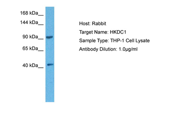 HKDC1 Rabbit Polyclonal Antibody