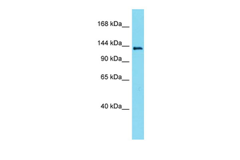 Lmtk3 Rabbit Polyclonal Antibody
