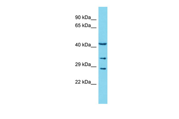 COLEC11 Rabbit Polyclonal Antibody