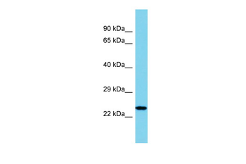IL34 Rabbit Polyclonal Antibody