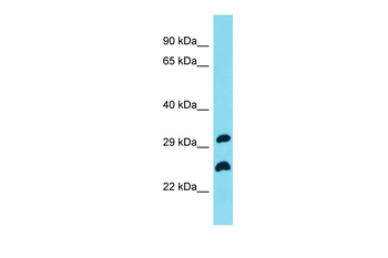 C19orf66 Rabbit Polyclonal Antibody