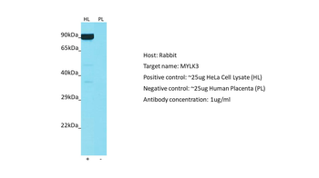 MYLK3 Rabbit Polyclonal Antibody