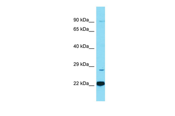 C1QTNF12 Rabbit Polyclonal Antibody