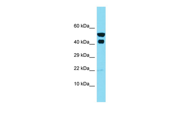 IKBIP Rabbit Polyclonal Antibody