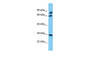 MRPS5 Rabbit Polyclonal Antibody