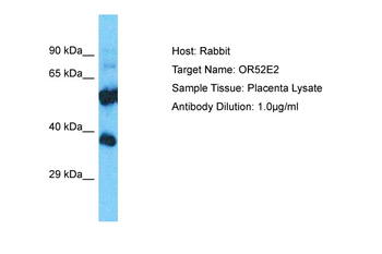 OR52E2 Rabbit Polyclonal Antibody