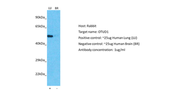 OTUD1 Rabbit Polyclonal Antibody