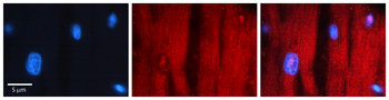 RCAN1 Rabbit Polyclonal Antibody