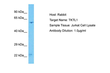 TKTL1 Rabbit Polyclonal Antibody