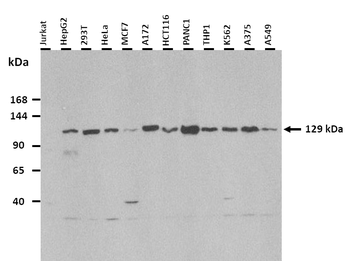 PDZD8 Rabbit Polyclonal Antibody