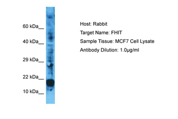 FHIT Rabbit Polyclonal Antibody