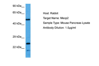 MECP2 Rabbit Polyclonal Antibody