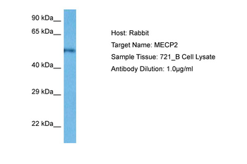MECP2 Rabbit Polyclonal Antibody