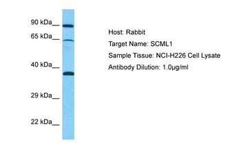 SCML1 Rabbit Polyclonal Antibody