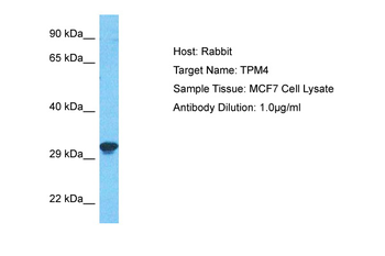 TPM4 Rabbit Polyclonal Antibody